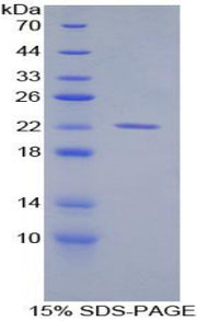 Figure 1. SDS-PAGE