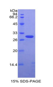 Figure 1. SDS-PAGE