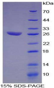 Figure 1. SDS-PAGE
