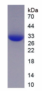 Figure 1. SDS-PAGE