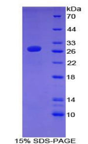 Figure 1. SDS-PAGE