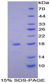 Figure 1. SDS-PAGE