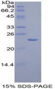 Figure 1. SDS-PAGE