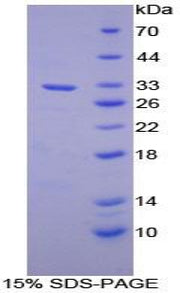 Figure 1. SDS-PAGE