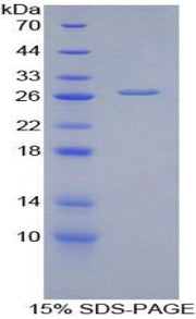 Figure 1. SDS-PAGE