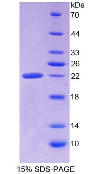 Figure 1. SDS-PAGE