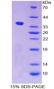 Figure 1. SDS-PAGE