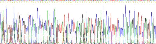 Recombinant Human Alpha-1-Acid Glycoprotein (a1AGP)