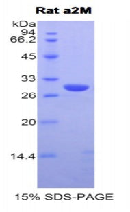 Figure 1. SDS-PAGE