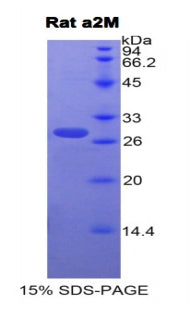 Figure 1. SDS-PAGE