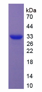 Figure 1. SDS-PAGE