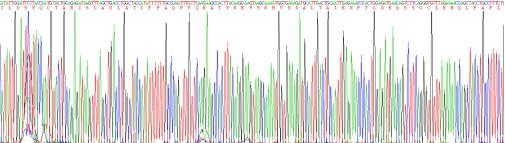 Recombinant Human Alpha-Fetoprotein (AFP)