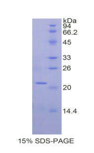 Figure 1. SDS-PAGE