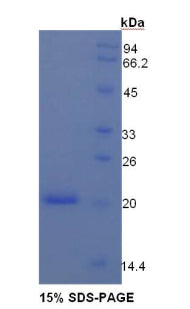 Figure 1. SDS-PAGE