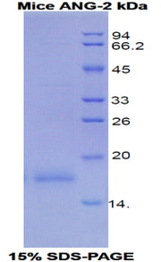 Figure 1. SDS-PAGE