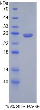 Figure 1. SDS-PAGE
