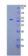 Figure 2. SDS-PAGE