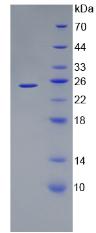 Figure 2. SDS-PAGE
