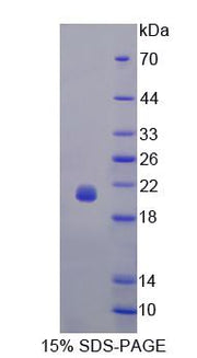 Figure 1. SDS-PAGE