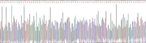 Recombinant Human Annexin A1 (ANXA1)