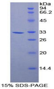 Figure 1. SDS-PAGE