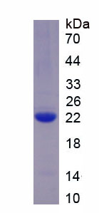Figure 1. SDS-PAGE