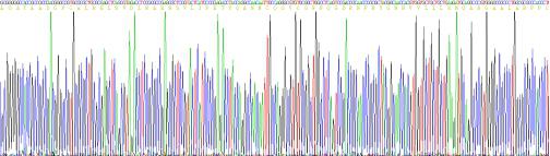 Recombinant Human Anti-Mullerian Hormone (AMH)