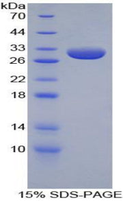 Figure 1. SDS-PAGE