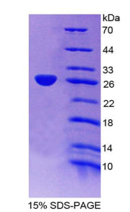 Figure 1. SDS-PAGE