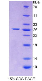 Figure 1. SDS-PAGE