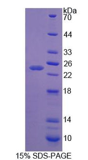 Figure 1. SDS-PAGE
