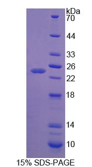 Figure 1. SDS-PAGE