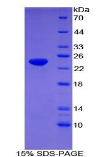 Figure 1. SDS-PAGE