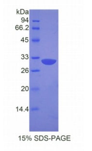 Figure 1. SDS-PAGE