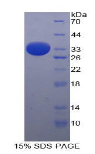 Figure 1. SDS-PAGE