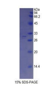 Figure 1. SDS-PAGE