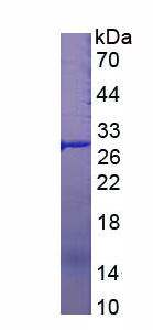 Figure 1. SDS-PAGE