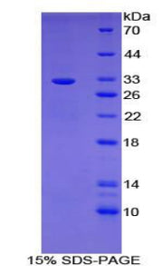 Figure 1. SDS-PAGE