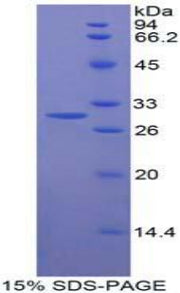 Figure 1. SDS-PAGE