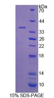 Figure 1. SDS-PAGE