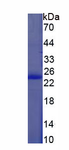 Figure 1. SDS-PAGE