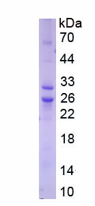 Figure 1. SDS-PAGE