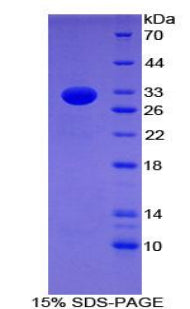 Figure 1. SDS-PAGE