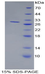 Figure 1. SDS-PAGE