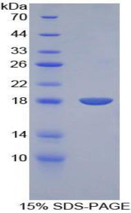 Figure 1. SDS-PAGE