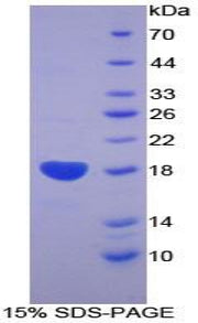 Figure 1. SDS-PAGE
