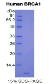 Figure 1. SDS-PAGE