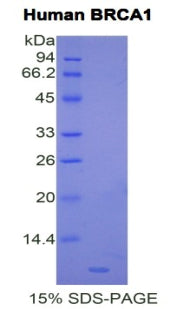 Figure 1. SDS-PAGE
