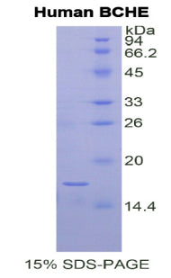 Figure 1. SDS-PAGE