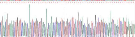 Recombinant Mouse C Reactive Protein (CRP)